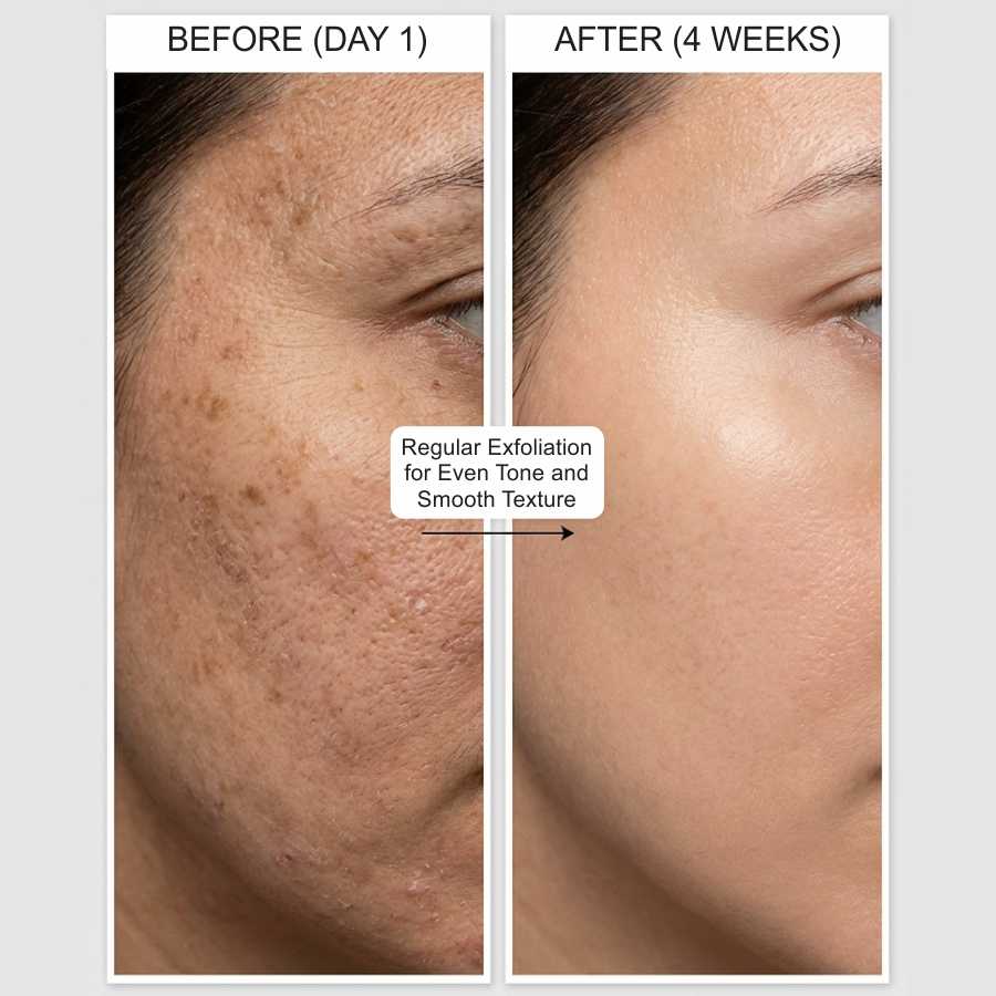 Glycolic Acid Toner 7% – Exfoliating & Brightening Face Toner