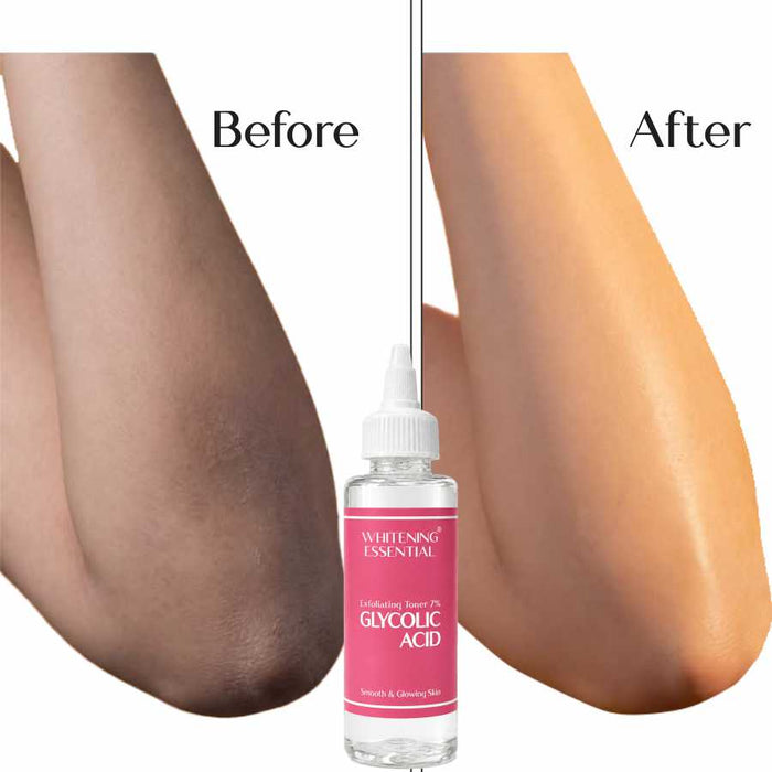 Anila Munir before and after